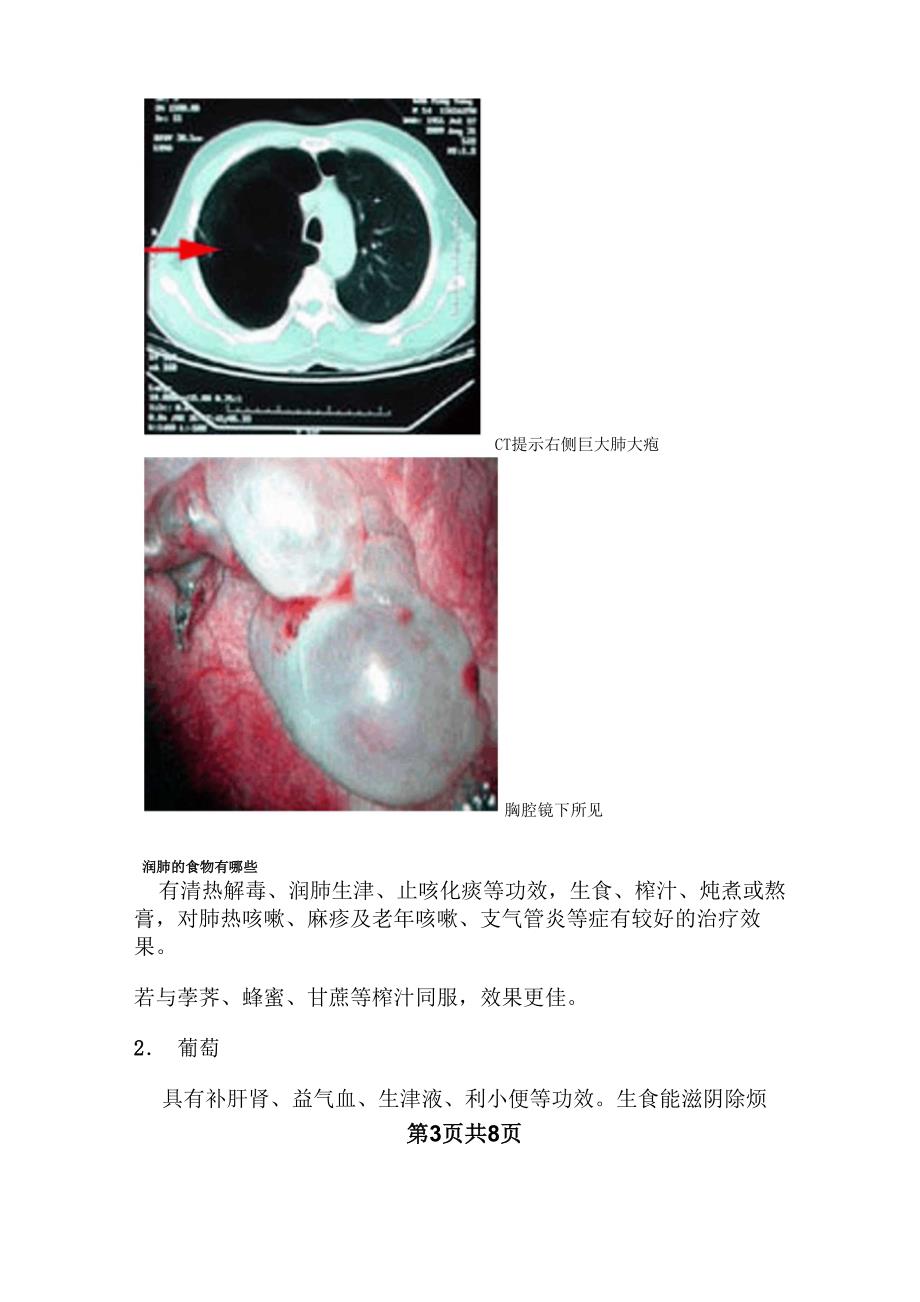 肺大泡最新治疗方案的探索与奇妙之旅