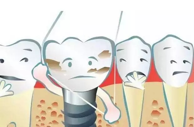 最新防蛀牙技术，守护您的灿烂笑容